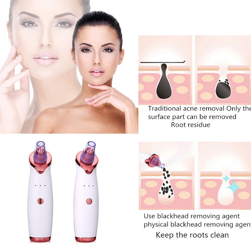 Laxswe GlowPro Blackhead Suction Device